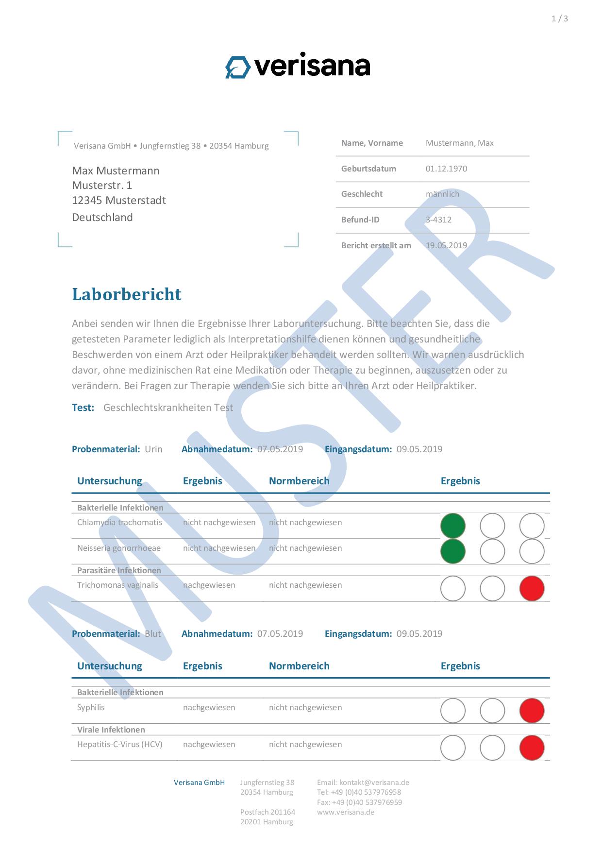 Testen welche geschlechtskrankheiten Wo kann