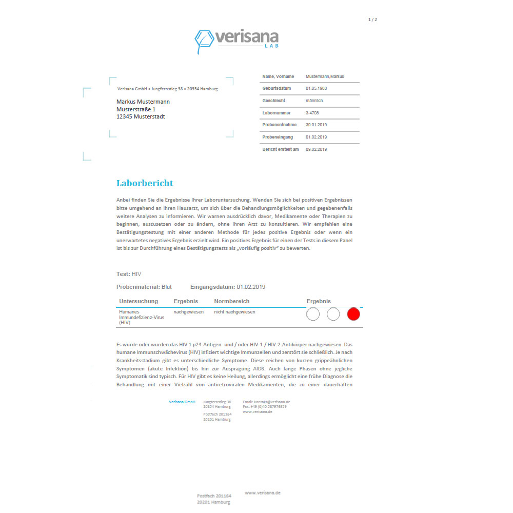 Hiv Test Der Humane Immunschwachevirus Verisana
