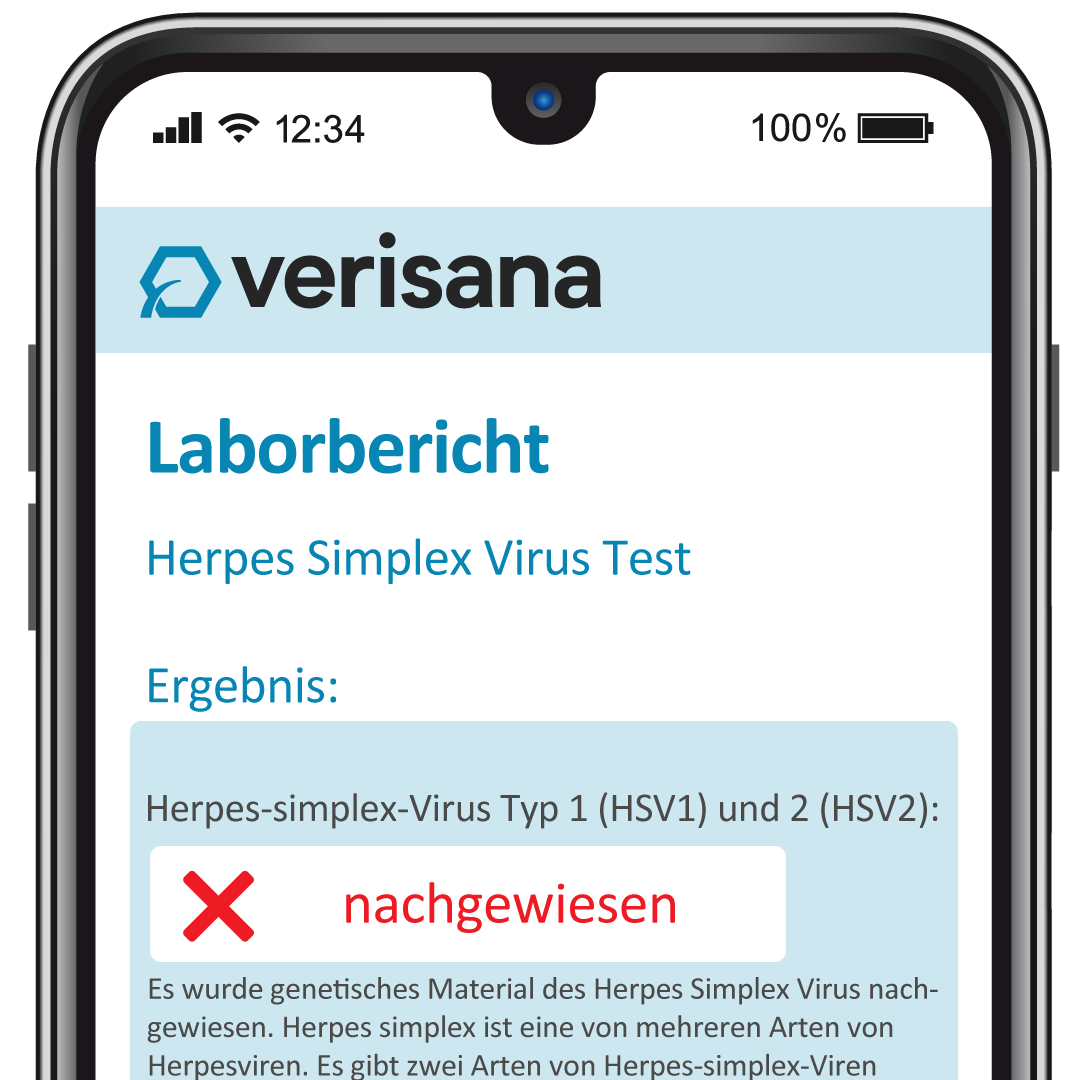 HSV Test Musterbefund Mobil