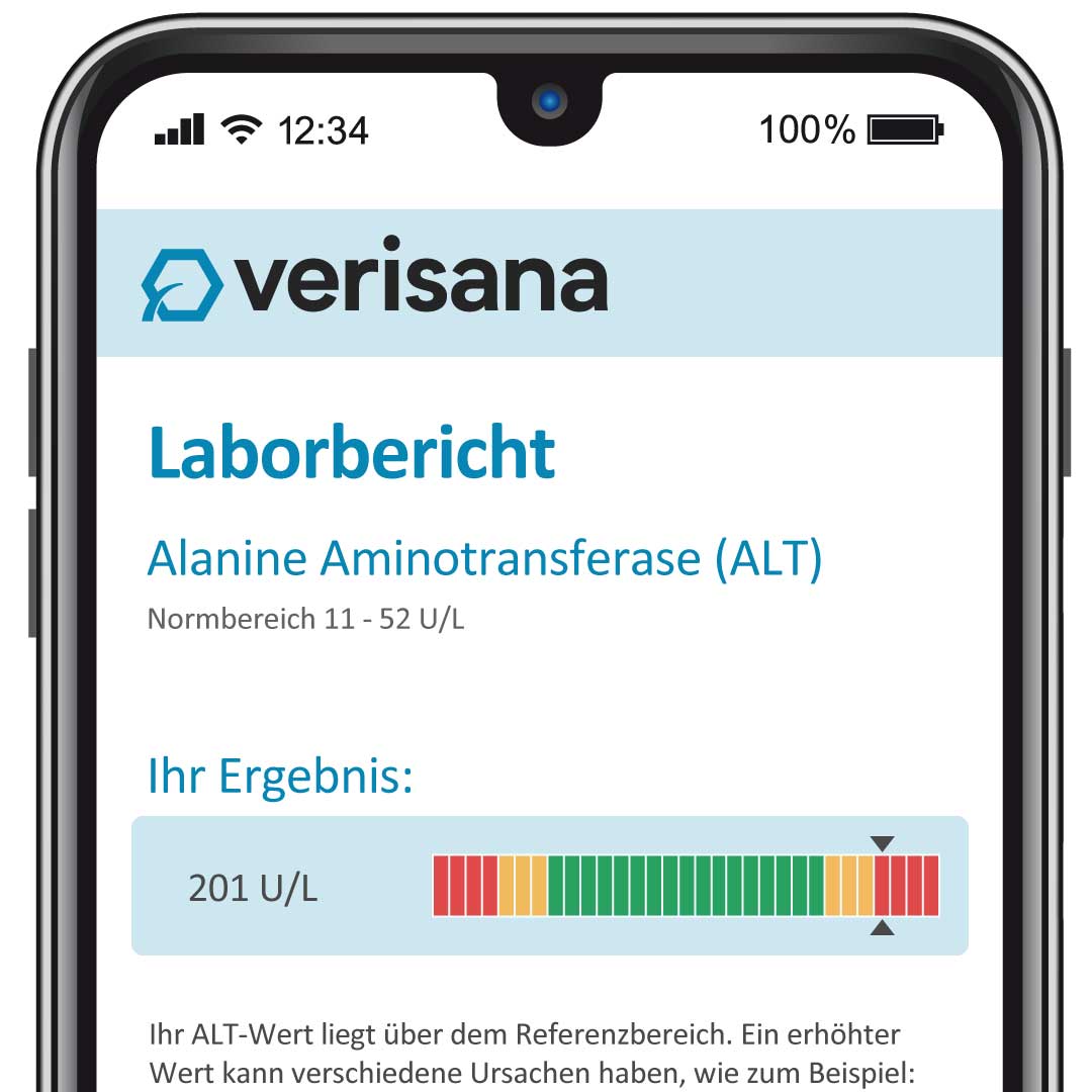 Musterbefund ALT
